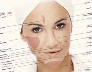 anti wrinkle injections Melbourne